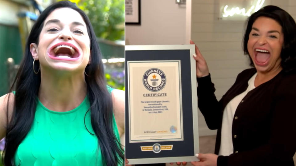 Samantha Ramsdell Wins Guinness World Record After Her Record Breaking Mouth Gape Went Viral On