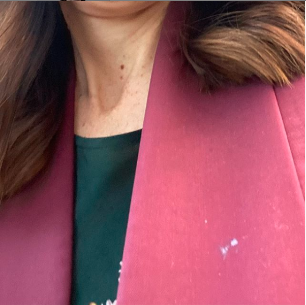 Jacinda Ardern with nappy cream on her blazer