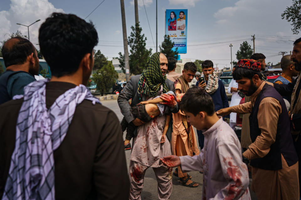 A man cradles an injured child after the Taliban use force to control crowds in Kabul. Source: Getty