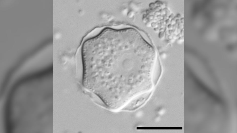 A photo of Acanthamoeba, the amoeba that causes a parasitic infection called keratitis.