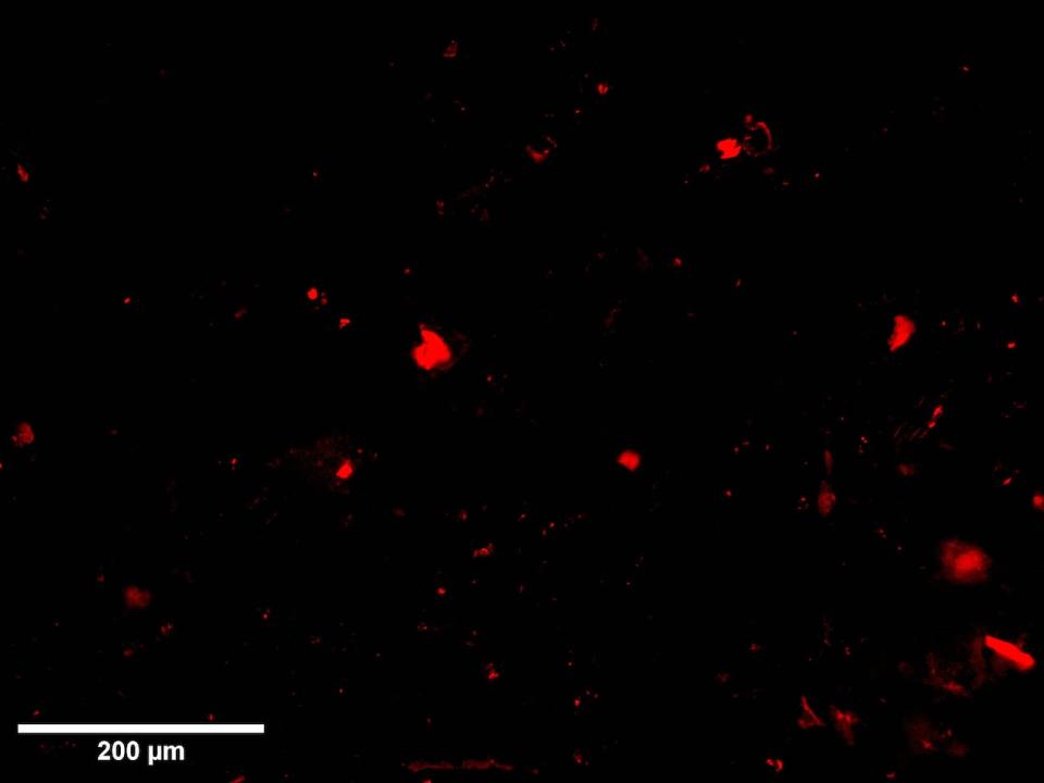 A sample of the microplastics collected by Dalhousie students during Hurricane Larry, seen through a microscope. 