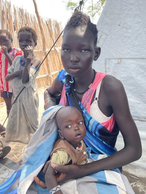 Nyajima Gatlak walked for a month to get herself and her 8-month-old baby Kang to a nutrition clinic in Canal Pigi, Jonglei, South Sudan. Kang was quickly assessed as being severely malnourished. / Credit: CBS News