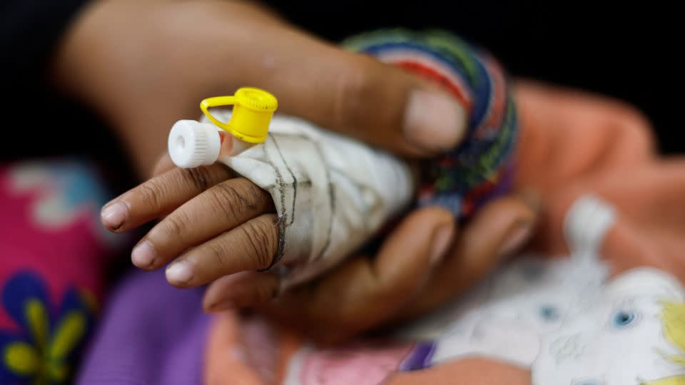 A Palestinian child suffering from malnutrition receives treatment at a healthcare center in Rafah, in southern Gaza, on March 4. Children and mothers are among those most at risk of severe malnutrition. - Mohammed Salem/Reuters