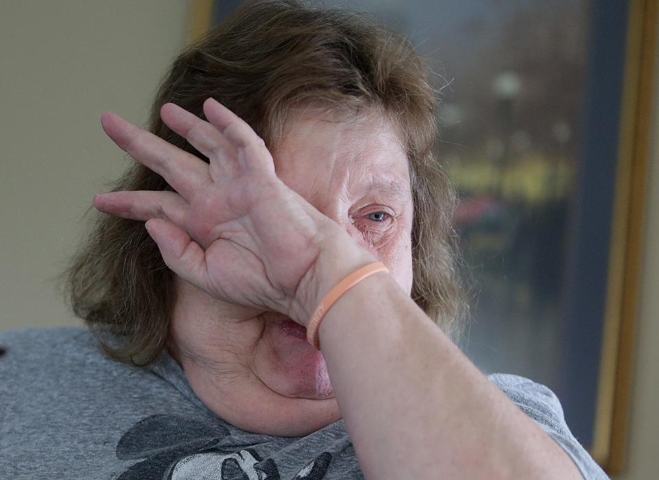 North Canton resident Judy Meade wipes tears from her eyes as she speaks about what she lost in her basement due to sewer backups following the heavy rainfall that hit the area on Saturday.