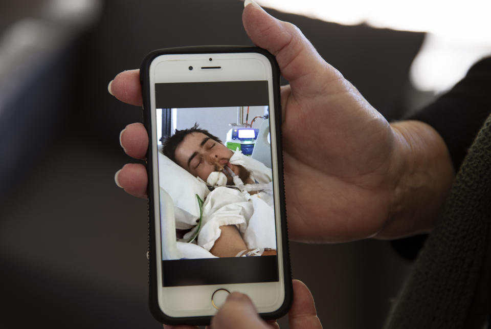 Deb Ware shows a photo she took of her son, Sam, 22, on life support from an overdose, in Fountaindale, Central Coast, Australia, Thursday, July 18, 2019. This was hardly the first overdose Sam had experienced since his addiction to pharmaceutical opioids began following a simple wisdom tooth extraction. But she wondered if it would be his last. He had somehow survived more than 60 overdoses in 12 months. (AP Photo/David Goldman)