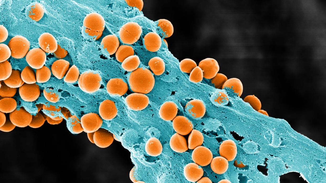  a microscopic image showing orange blobs sticking to a green tree-like object 