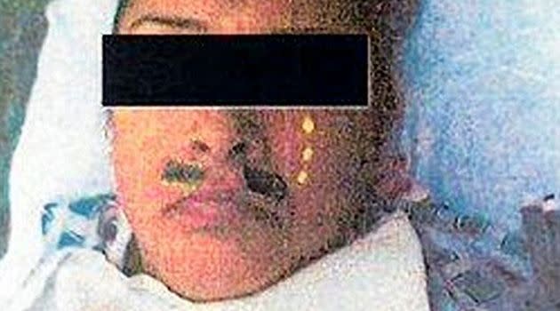 Veronica Valdez, 36, had her face decorated with stickers by her anesthesiologist to make it look like she has a mustache and teardrops while she was unconscious during surgery. Photo: Los Angeles County Superior Court