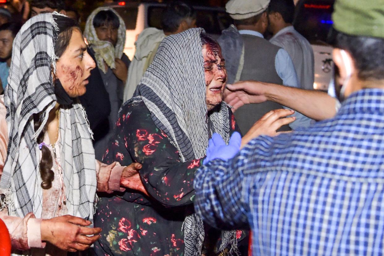 Wounded women arrive at a hospital for treatment after two blasts, which killed at least five and wounded a dozen, outside the airport in Kabul on August 26, 2021. (Wakil Kohsar/AFP via Getty Images)