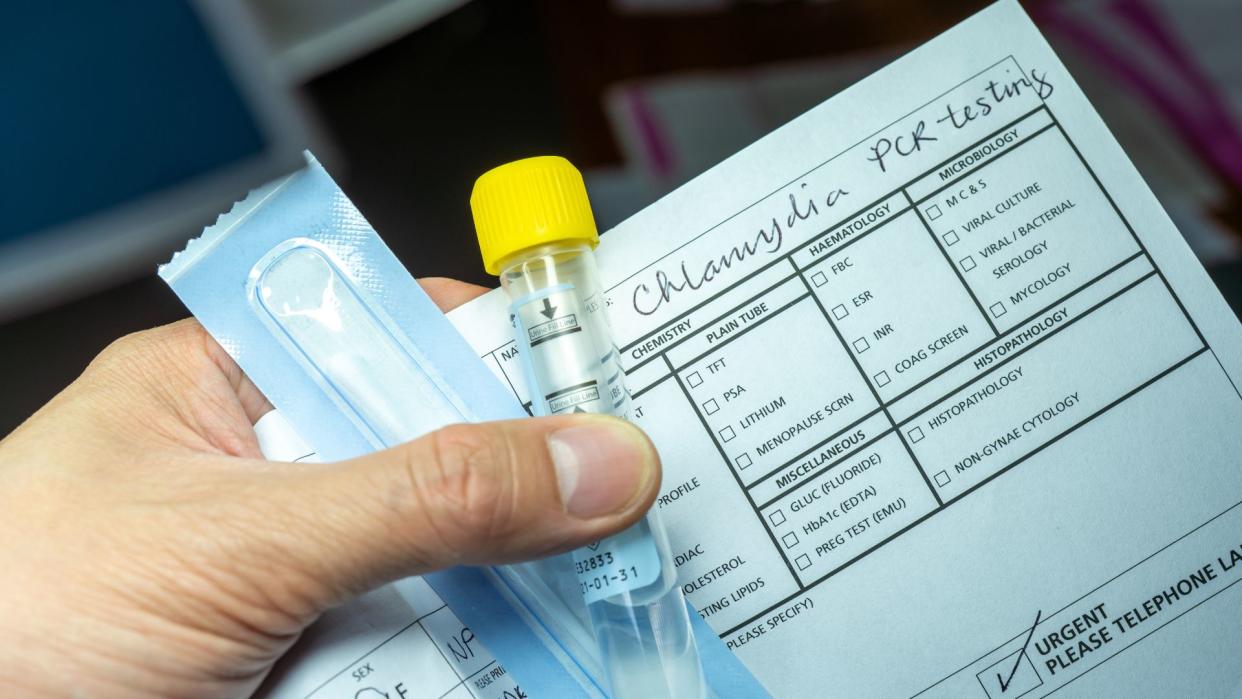  closeup of an adult's hand holding a swab used for STI testing in a sealed package, a sample collection tube, and a piece of paper that reads "chlamydia pcr testing" at the top 