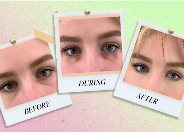 This TikTok Beauty Trend Made Me Put Blush on My Undereye Circles