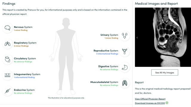 What Is the Prenuvo Whole-Body Scan?