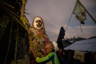 <p>Mumtaz Begum, 30, with bandages covering her wounds, is held by her daughter Rosia, 8, on October 15, standing outside their makeshift tent in Balukhali camp, Cox’s Bazar. Mumtaz arrived over a month ago from Myanmar. She suffered injuries after being attacked with a machete and was burned after Burmese military torched their house with everyone inside; she says that they locked the door, so she had to crawl out to escape to survive. She lost 6 member of her family, including 3 sons and 1 daughter. (Photograph by Paula Bronstein/Getty Images) </p>