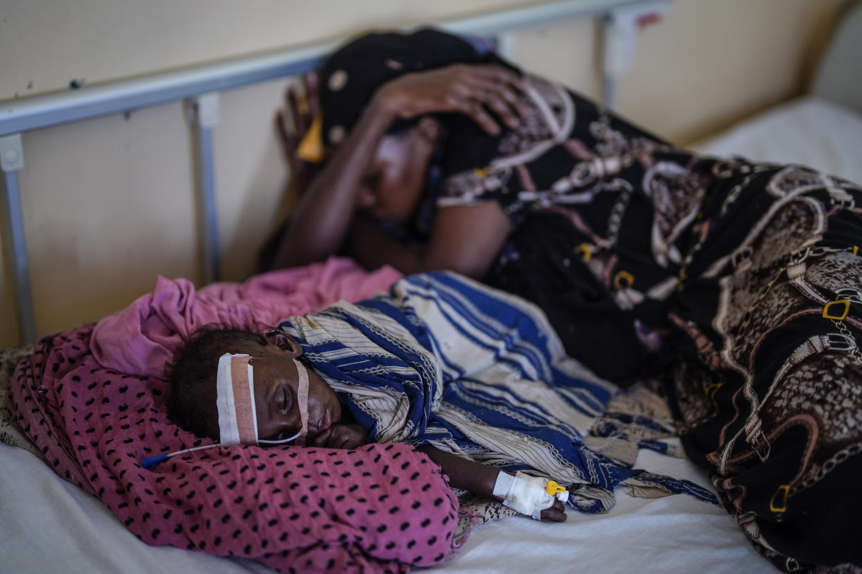 Una madre somalí duerme a un lado de su hijo con desnutrición grave en el hospital Banadir en Mogadiscio, Somalia, el 8 de enero de 2023. (Giles Clarke/The New York Times)
