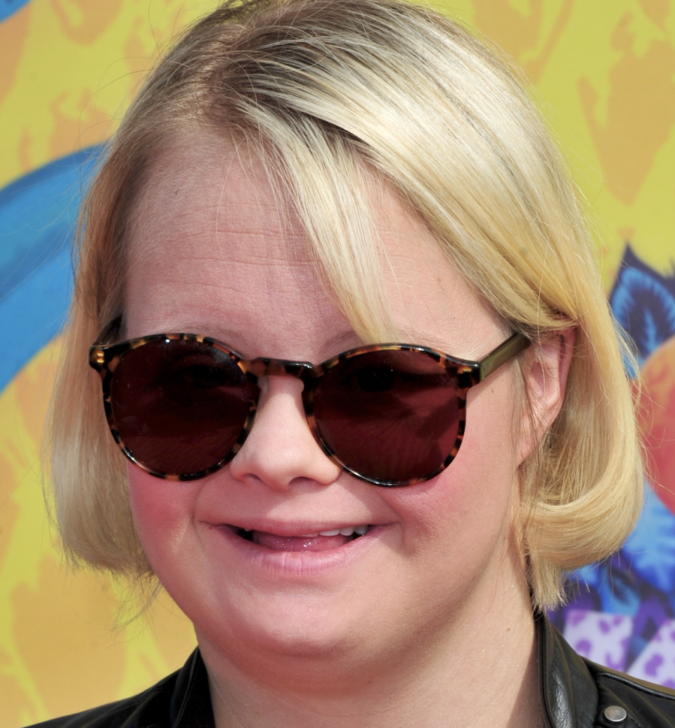 Glee actress Lauren Elizabeth Potter has partnered with the Down Syndrome Association, the American Association of People with Disabilities, and Special Olympics to advocate for people with disabilities. (Photo by Frazer Harrison/Getty Images)