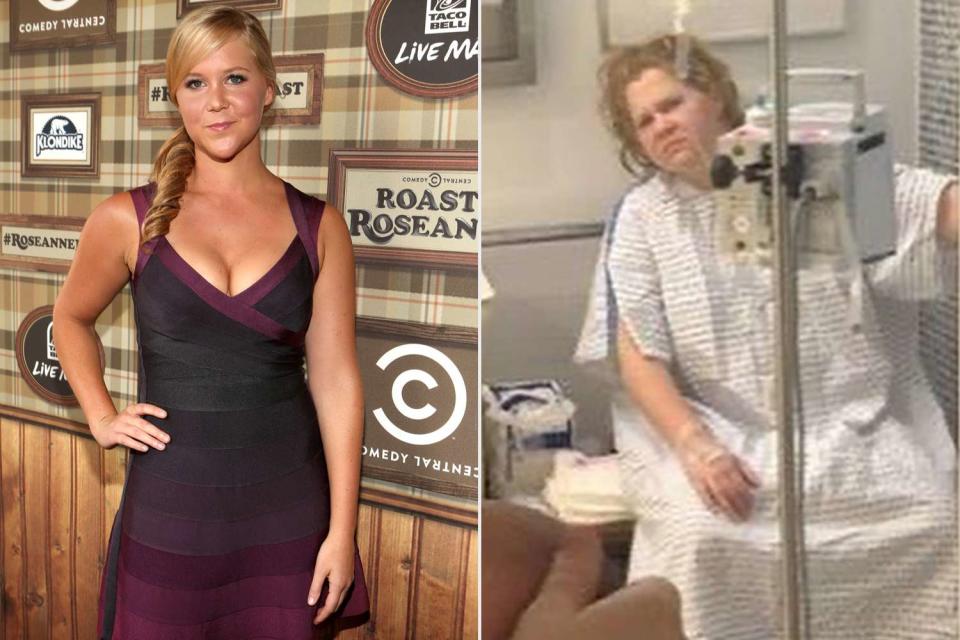 <p>Christopher Polk/Getty, Amy Schumer/Instagram</p> Amy Schumer shared a photo of herself in 2012 and a more recent picture of herself in a hospital on Instagram.