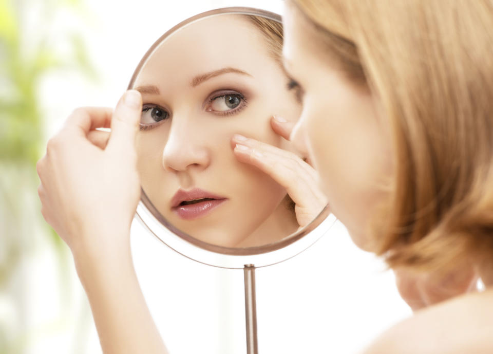 El acné hormonal o acné de la mujer adulta es un padecimiento cada vez más frecuente / Foto: Thinkstock