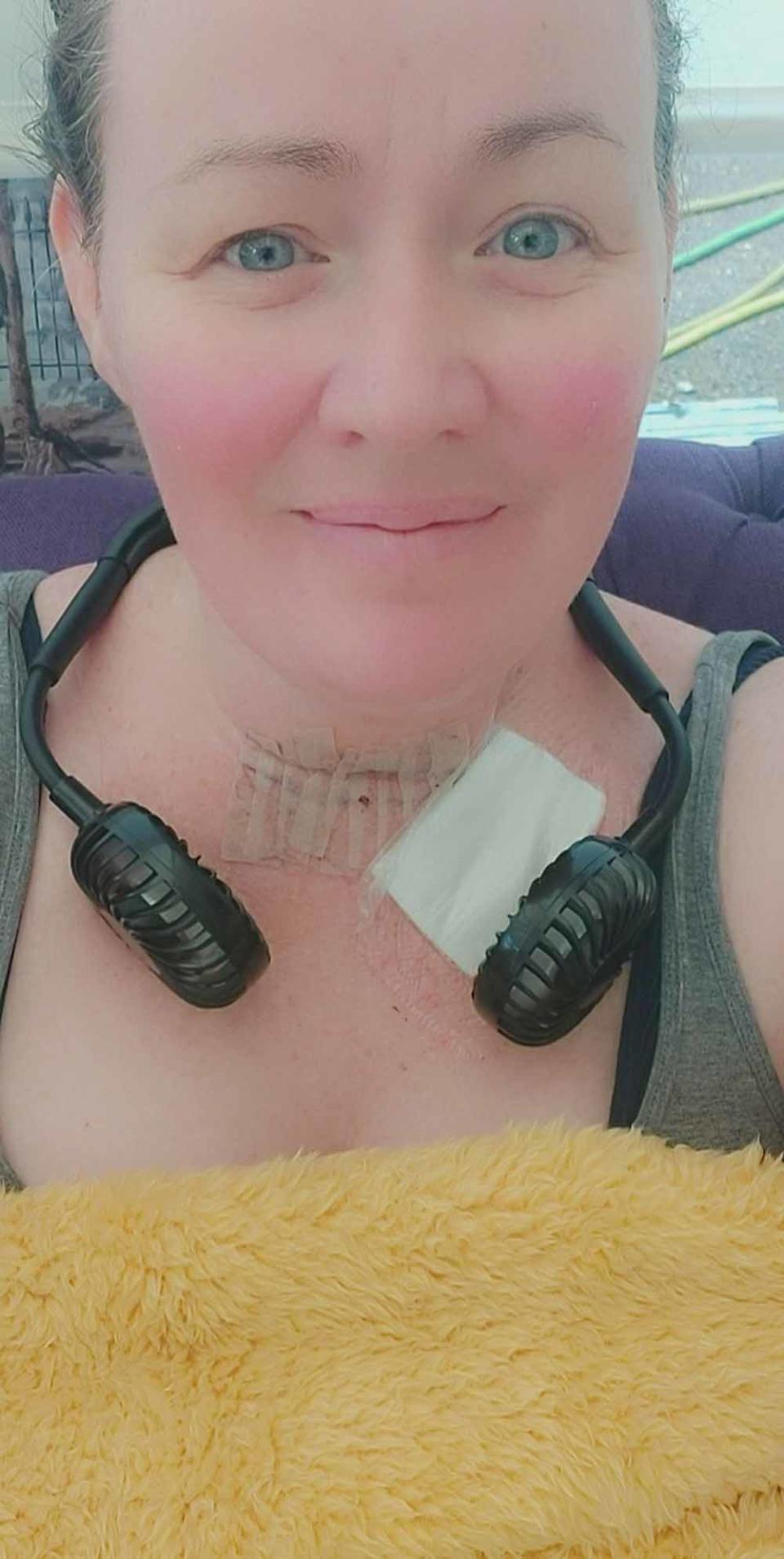 Jemma while her neck was healing. PA REAL LIFE COLLECT