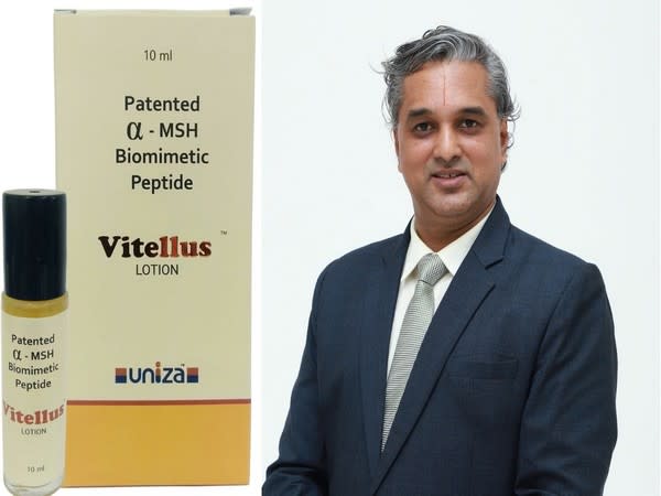 Uniza Group launches a novel solution for the management of Vitiligo