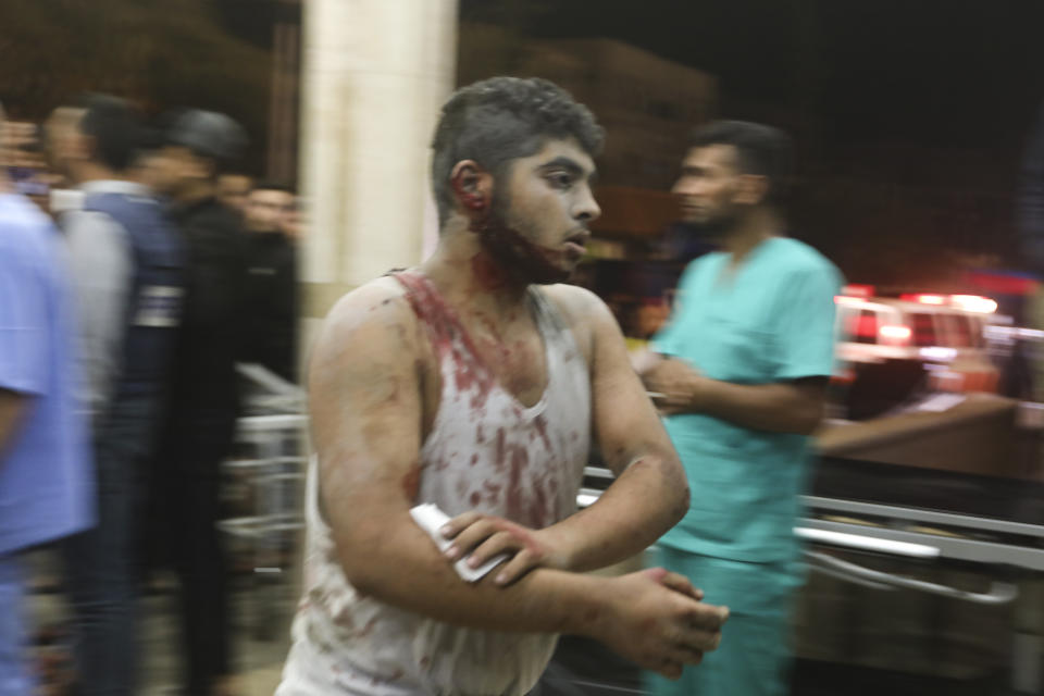 A wounded Palestinian man arrives at the Nasser Medical Complex, following Israeli airstrikes on town of Khan Younis, southern Gaza Strip, Monday, Oct. 23, 2023. (AP Photo/Mohammed Dahman)