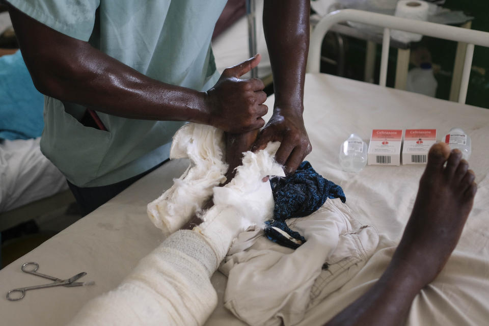 A doctor removes Jertha Ylet's cast at the Immaculate Conception Hospital, also known as the General Hospital of Les Cayes in Les Cayes, Haiti, Monday, Aug. 23, 2021, a week after a 7.2 magnitude earthquake brought down her house in Camp-Perrin. Ylet represents an emerging dilemma for the region’s limited health care services: how to turn over hospital beds when discharged patients have no place to go. (AP Photo/Matias Delacroix)