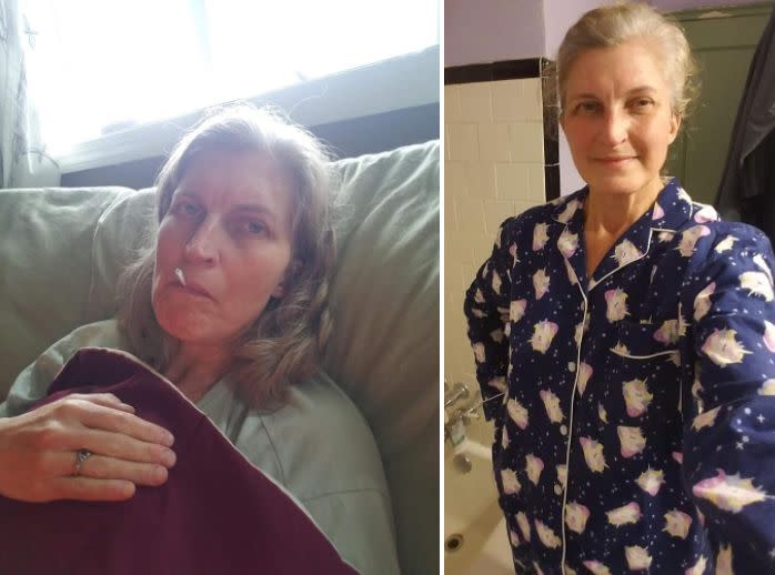 Left: Joyner during the third week of her illness. Right: During the seventh week of illness. She had lost 12 pounds by that point, she said. (Photo: Stephanie Joyner)