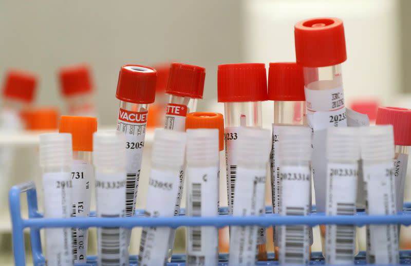 The coronavirus disease (COVID-19) tests are seen in a laboratory at the CHIREC Delta Hospital in Brussels