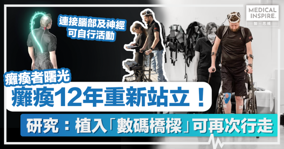 癱瘓者曙光 │ 癱瘓12年重新站立！ 研究：植入「數碼橋樑」可再次行走