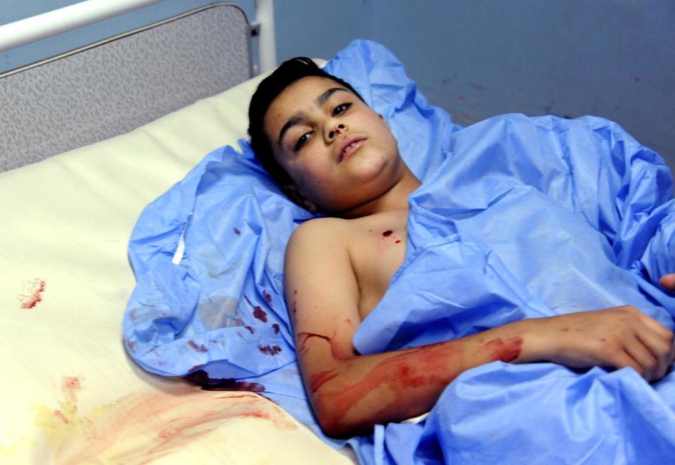 In this photo which AP obtained from the Syrian official news agency SANA, and has been authenticated based on its contents and other AP reporting, a wounded Syrian boy lays on a hospital bed to receive treatment in Damascus, Syria, Tuesday, April 29, 2014. A series of mortar shells slammed into central Damascus on Tuesday, killing more than a dozen people and wounding scores, state media reported. The attacks in the Syrian capital came a day after President Bashar Assad announced his candidacy for the June 3 presidential election. (AP Photo/SANA)