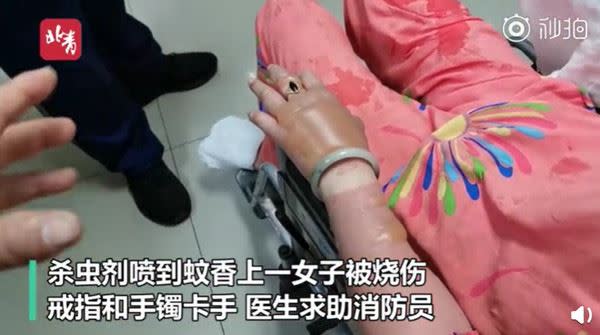 女子手部與臉部都有嚴重傷燙傷。（圖／翻攝自青流視頻）