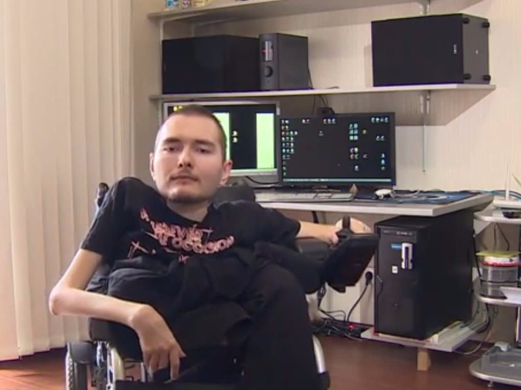 The world’s first head transplant patient could experience a fate