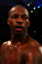 ATLANTIC CITY, NJ - APRIL 28: Chad Dawson looks on as blood drips down his chest after he was cut above his left eye by an accidental head butt from Bernard Hopkins during their WBC & Ring Magazine Light Heavyweight Title fight at Boardwalk Hall Arena on April 28, 2012 in Atlantic City, New Jersey. (Photo by Al Bello/Getty Images)