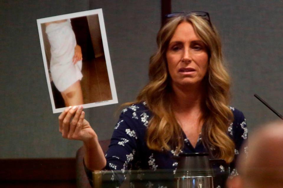 Stephanie Barnard, the ex-wife of Judge Sam Swanberg, holds up a photo for the jury showing a bruise she says he caused during a physical altercation. The judge was acquitted of domestic violence.