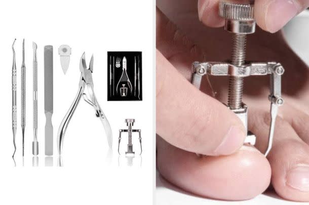 I'm just saying, this ingrown toenail kit has gotten some incredible reviews.