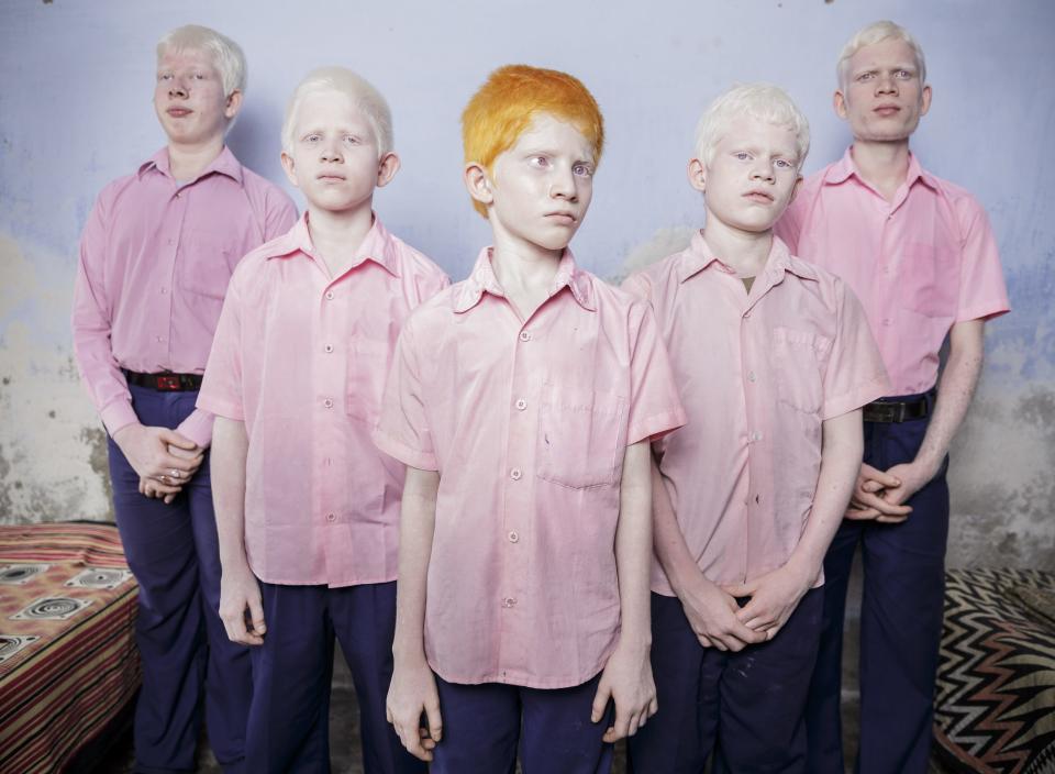 Brent Stirton, a South African photographer working for Reportage by Getty Images won the 1st Prize People - Staged Portraits Single category of the 2014 World Press Photo contest with this picture of a group of blind albino boys in their boarding room at the Vivekananda mission school for the blind in West Bengal, taken September 25, 2013. REUTERS/Brent Stirton/World Press Photo Handout via Reuters