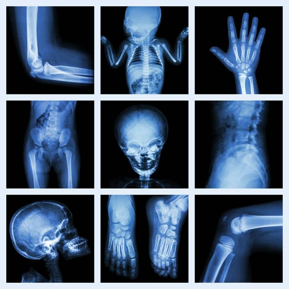 x-rays of babies