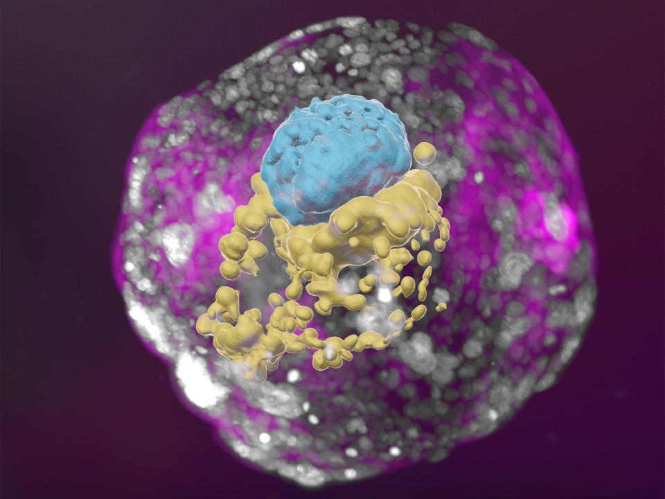 A stem cell–derived human embryo model at a developmental stage equivalent to that of a day 14 embryo. The model has all the compartments that define this stage: the yolk sac (yellow) and the part that will become the embryo itself, topped by the amnion (blue) – all enveloped by cells that will become the placenta (pink).