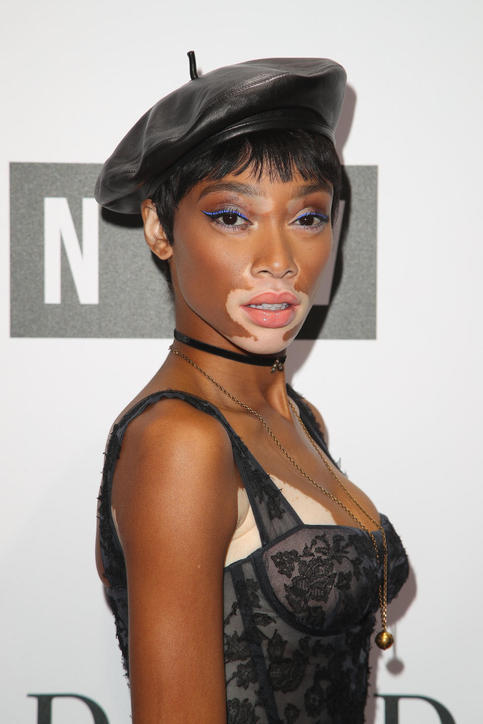 Winnie Harlow