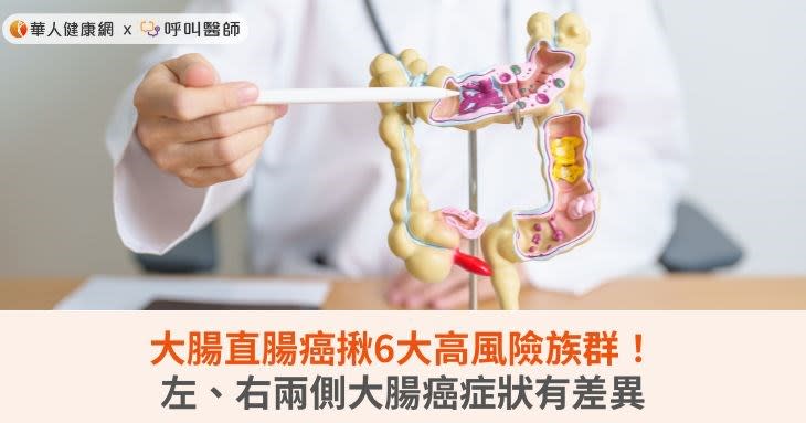 大腸直腸癌揪6大高風險族群！左、右兩側大腸癌症狀有差異