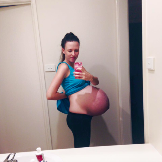 This mom's bump picture went viral for all the wrong reasons. (Photo: Facebook/The Shutup Meg Blog)