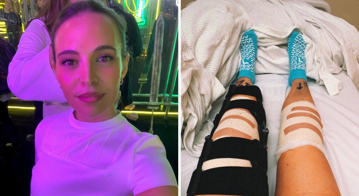 Talia Lazarus had to learn to walk again after an e-scooter accident left her with extensive injuries. (Talia Lazarus/SWNS)