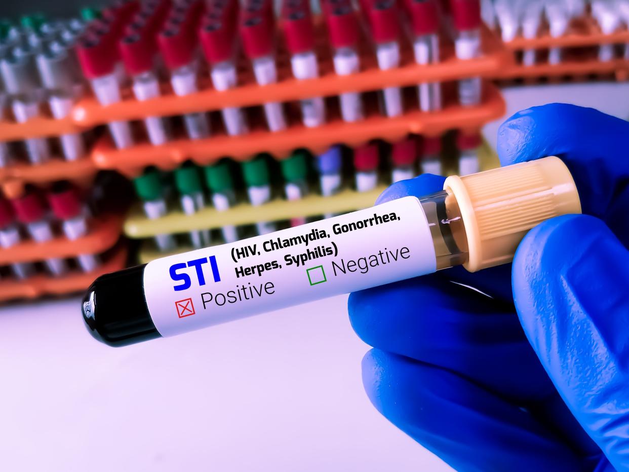 A biochemist or lab technologist holds a blood sample for a Sexually Transmitted Infection test.