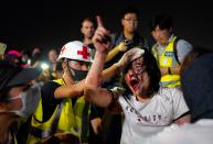 A medic treats a pro-Beijing man after he was hit by protesters for waving a Chinese national flag during a rally at Tamar park in Hong Kong, Saturday, Sept. 28, 2019. Thousands of people gathered Saturday for a rally in downtown Hong Kong, belting out songs, speeches and slogans to mark the fifth anniversary of the start of the 2014 Umbrella protest movement that called for democratic reforms in the semiautonomous Chinese territory. (AP Photo/Vincent Yu)