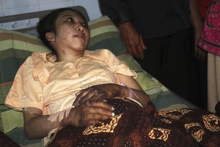 Indonesian domestic helper Erwiana Sulistyaningsih lies in a bed whilst being treated at a hospital in Sragen, Indonesia's Central Java province January 17, 2014. REUTERS/Stringer