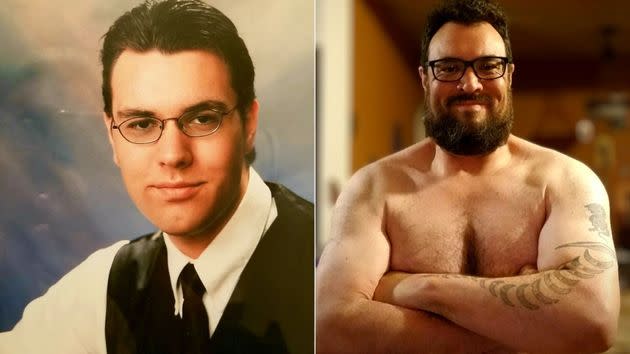 James Peña DeRoach as teen (left), and today, after getting gyno surgery. (Photo: James Peña DeRoach)