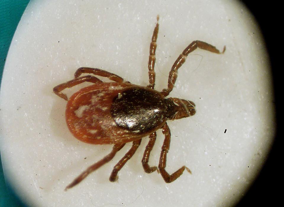 A deer tick is shown under a microscope in the entomology lab at the University of Rhode Island in South Kingstown.