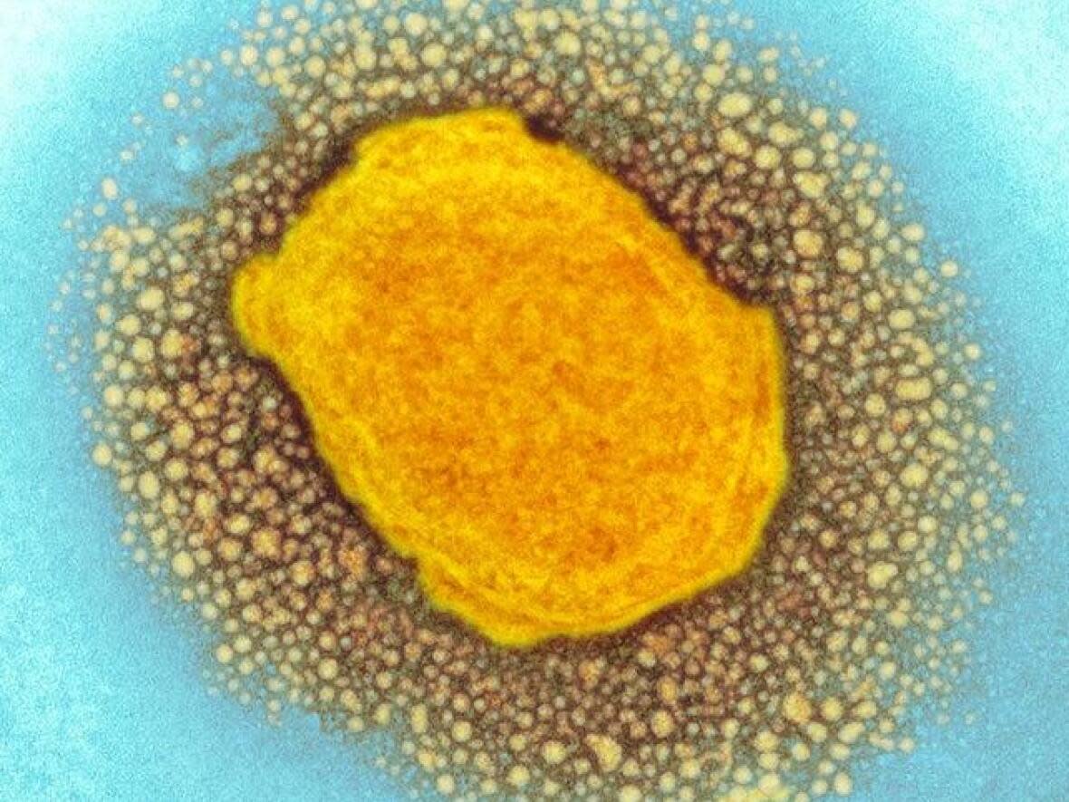 This image shows a monkeypox virus particle that has been coloured. (U.K. Health Security Agency/Science Photo Library - image credit)