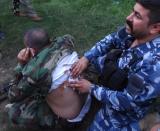 A member of the Iraqi Kurdish forces gets treatment after being injured during clashes with jihadist gunmen in the southern suburbs of the northern city Kirkuk on October 21, 2016