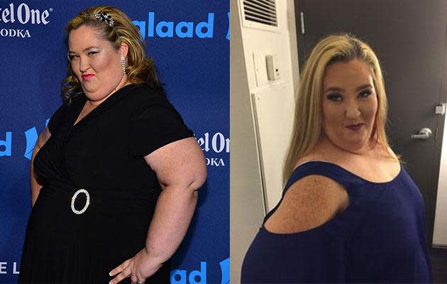 New Botched episode sees woman who has slimmed down by 10 inches