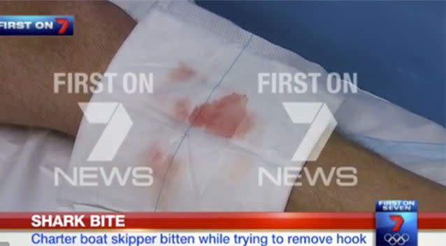 A man has been bitten by a shark approximately 20km off the Gold Coast during a fishing charter. Source: 7 News.