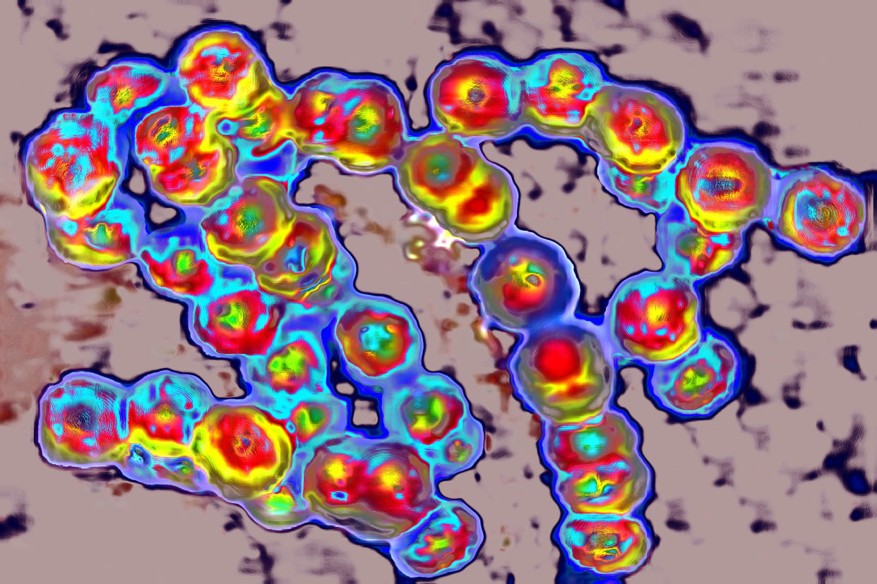 Streptococcus Round Shaped Bacteria Gram Positive Cocci, Which Group Characteristically In Chains Resembling A String Of Pearls. The Bacteria Is Involved In Various Pathologies Scarlet Fever, Sore Throat, Septicemia, Meningitis, Newborn Infections, Endocarditis, Pneumonia, Erysipelas, Erythema Nodosum, Rhumatoid Purpura, Urinary Infection. (Photo By BSIP/UIG Via Getty Images)